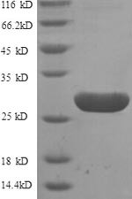 G-protein coupled receptor 161 (GPR161), partial, human, recombinant
