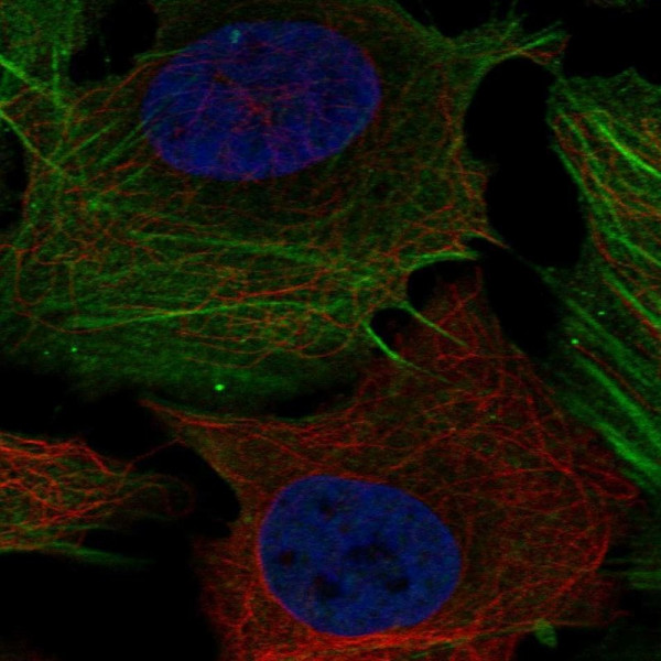 Anti-PHOSPHO1