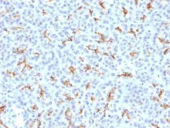 Anti-CFTR / Cystic Fibrosis Transmembrane Regulator