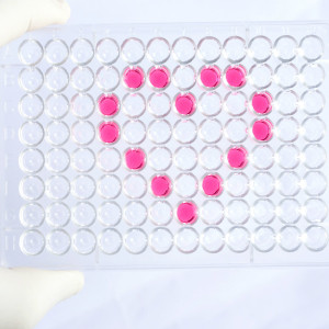 Human Nitric oxide synthase, endothelial (NOS3) ELISA Kit