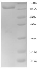 Inositol-trisphosphate 3-kinase B (ITPKB), partial, human, recombinant