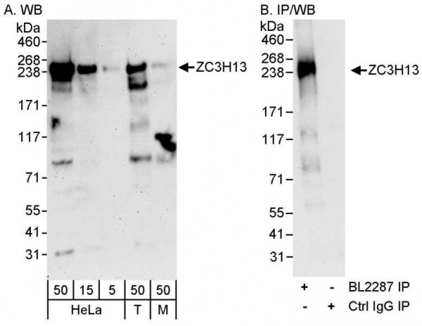 Anti-ZC3H13