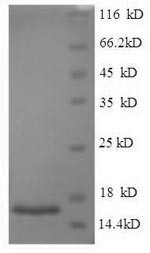 Acrosomal protein SP-10 (ACRV1), human, recombinant