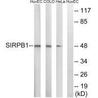 Anti-SIRPB1