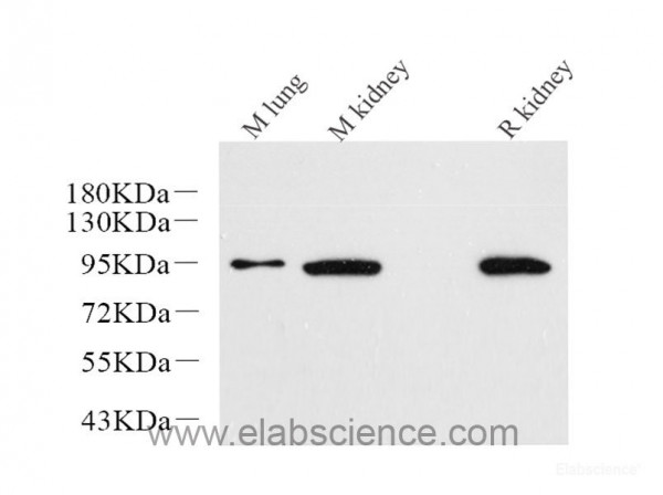 Anti-Catenin beta, clone 4A3H3