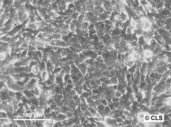 Hep-56.1B Cells