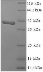 SWI/SNF complex subunit SMARCC1 (SMARCC1), partial, human, recombinant