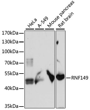 Anti-RNF149