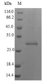 Snaclec rhodocytin subunit beta, Calloselasma rhodostoma, recombinant