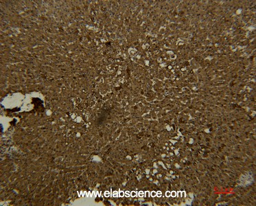 Anti-Transferrin, clone 7H11