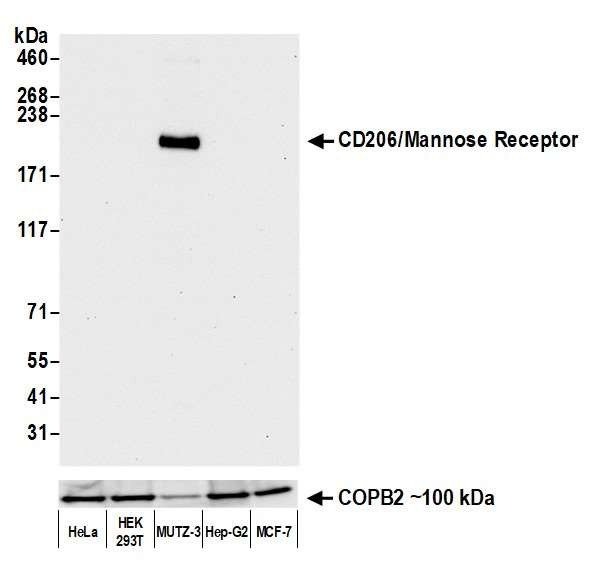 Anti-CD206/Mannose Receptor Recombinant Monoclonal