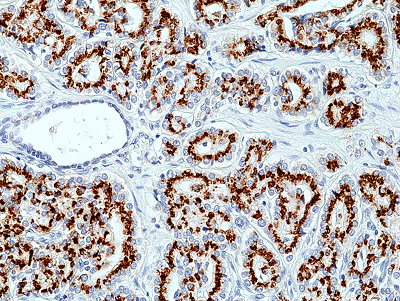 Anti-Prostein (human), Rabbit Monoclonal (RM426)