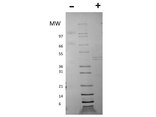 Interleukin-12