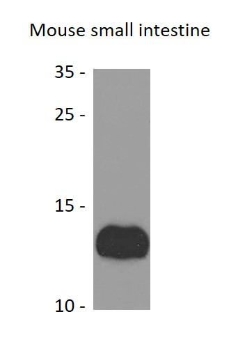 Anti-Uroguanylin