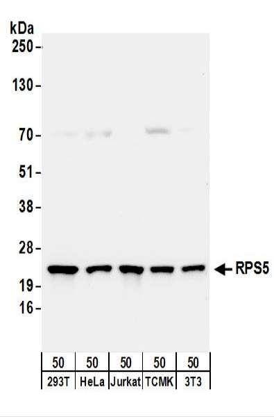 Anti-RPS5