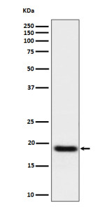 Anti-TNFAIP8 / Tumor necrosis factor alpha induced protein 8, clone 30T22