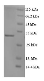 DNA repair protein complementing XP-C cells (XPC), partial, human, recombinant
