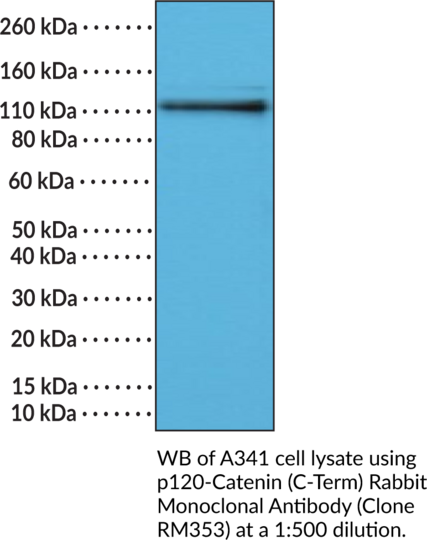 Anti-p120-Catenin (C-Term) Rabbit Monoclonal Antibody (Clone RM353)