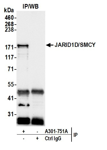 Anti-JARID1D/SMCY