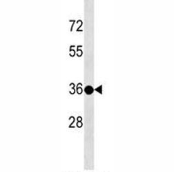 Anti-TSPY3