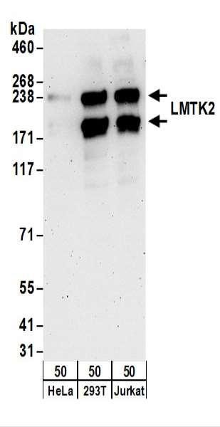 Anti-LMTK2