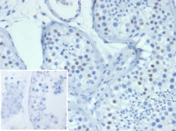 Anti-WT1 / Wilms Tumor 1, clone WT1/7450