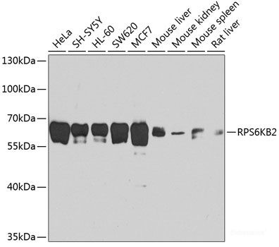 Anti-p70 S6 kinase beta