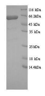 GRB10-interacting GYF protein 2 (GIGYF2), partial, human, recombinant