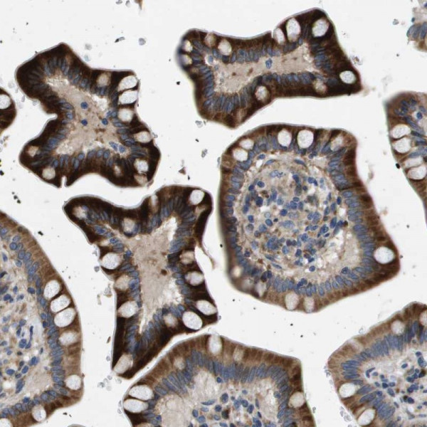 Anti-ENTPD2