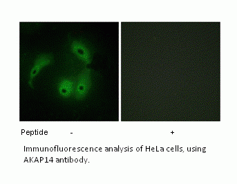 Anti-AKAP14