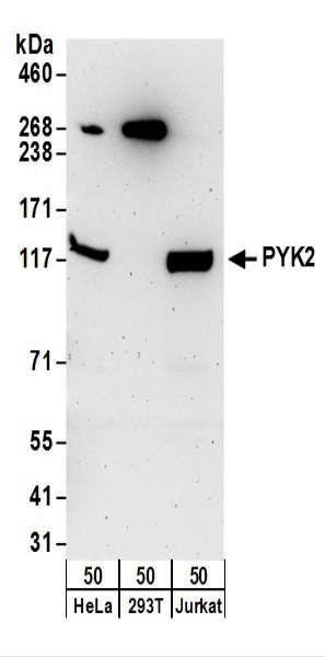 Anti-PYK2