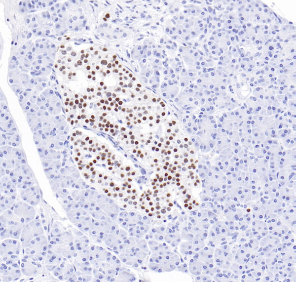 Anti-Islet 1, clone SQab30356