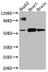 Anti-CYP17A1 Recombinant Monoclonal, clone 5A9