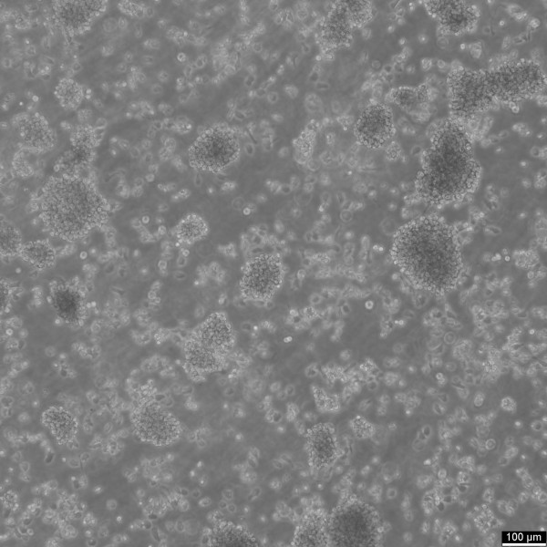 Y3-Ag 1.2.3 Cells