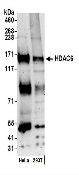 Anti-HDAC6