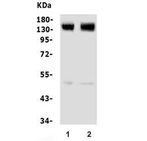 Anti-Glutamate Metabotropic Receptor 5 / GRM5