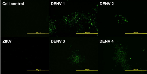 Anti-Dengue virus NS1, clone SQab1501