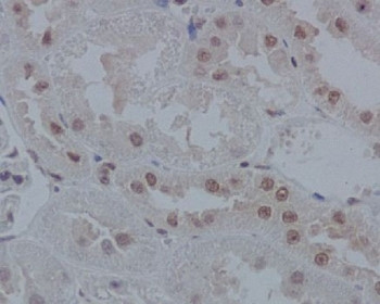 Anti-IRF1, clone DHE-9