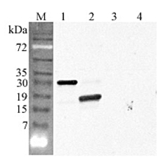 Anti-CTRP5 (globular domain) (human)