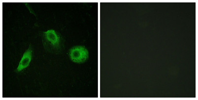 Anti-phospho-PLC gamma2 (Tyr1217)