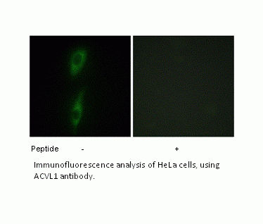Anti-ACVL1