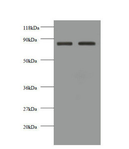 Anti-CDH12