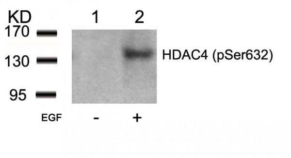 Anti-phospho-HDAC4 (Ser632)