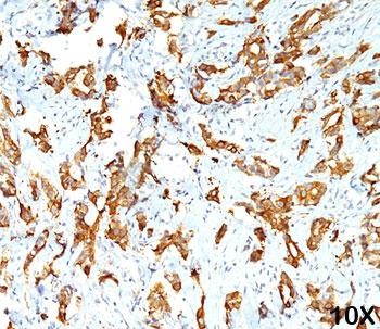 Anti-HSP27, clone G3.1