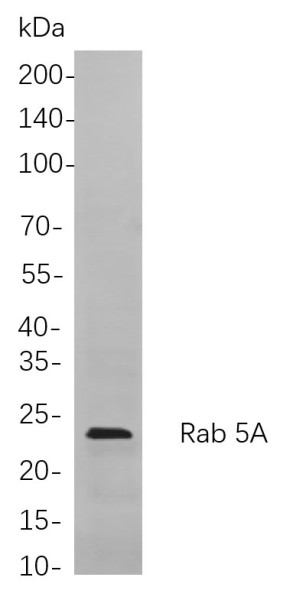 Anti-Recombinant Rab 5A, clone 12B10