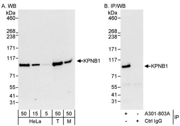 Anti-KPNB1