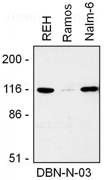 Anti-Drebrin Monoclonal Antibody (Clone:DBN-N-03)