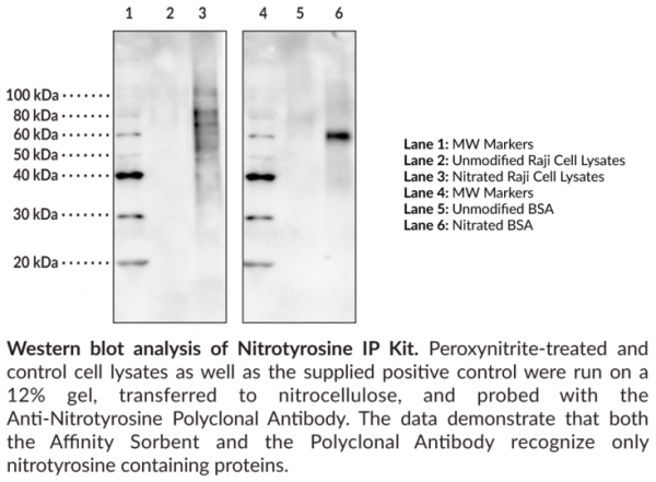 Nitrotyrosine IP Kit