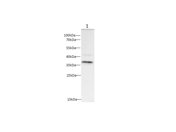 Anti-CD20
