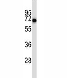 Anti-CD5